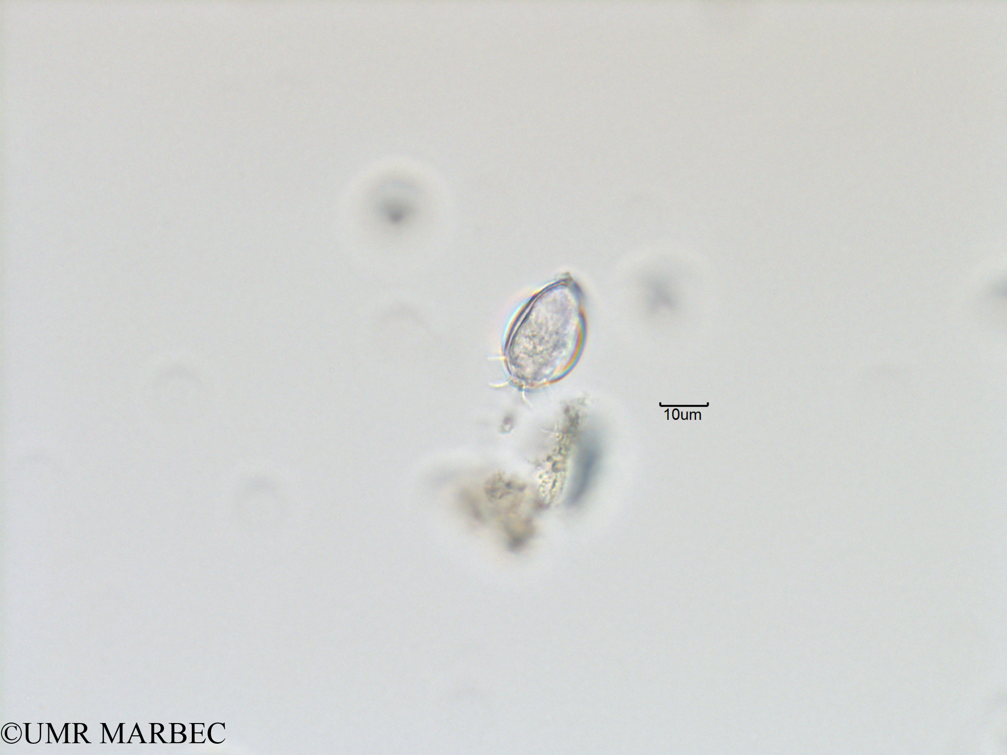 phyto/Bizerte/bizerte_bay/RISCO November 2015/Dinophysis sp2 (Baie_T5-ACW1-cf dinophysis-9).tif(copy).jpg